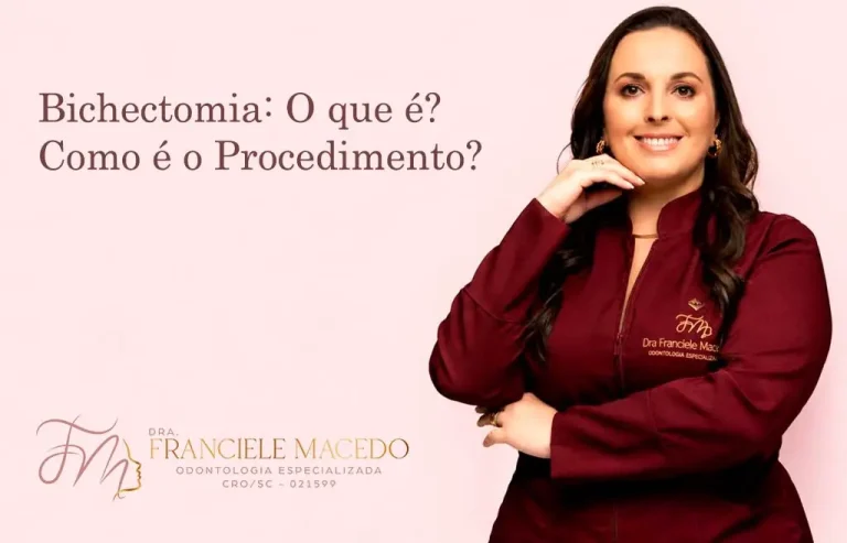 Bichectomia: O que é? Como é o Procedimento? - Dra. Franciele Macedo Odontologia em Blumenau, Vale do Itajaí/SC.