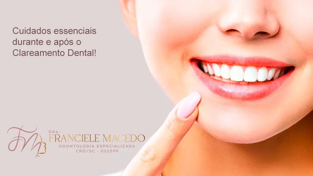 Cuidados Essenciais Durante e Após o Procedimento: Dra. Franciele Macedo Odontologia Eespecialista em Clareamento Dental no Vale do Itajaí/SC. Cuidados Essenciais Durante e Após o Procedimento: Dra. Franciele Macedo Odontologia Eespecialista em Clareamento Dental no Vale do Itajaí/SC.