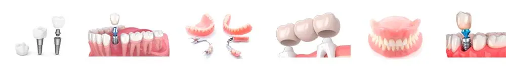 Tipos de Próteses Dentárias - Carlos Gomes Odontologia