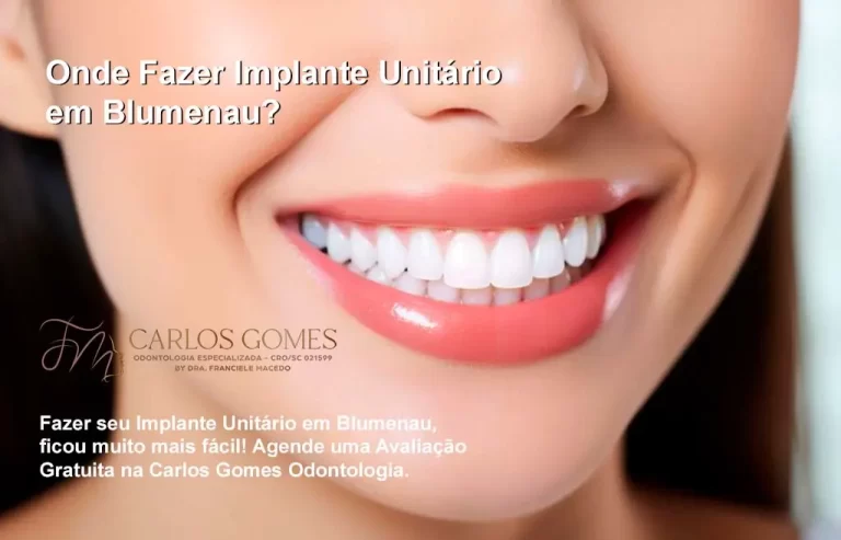 Onde Fazer Implante Unitário em Blumenau?