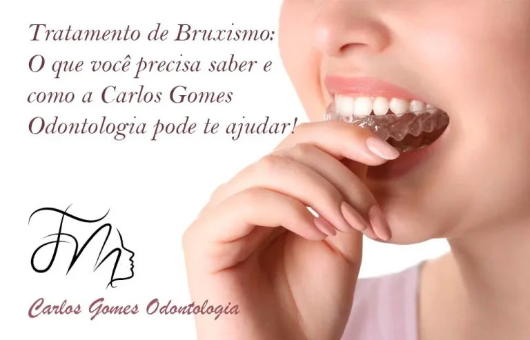 Tratamento de Bruxismo: o que você precisa saber e como a Carlos Gomes Odontologia pode te ajudar