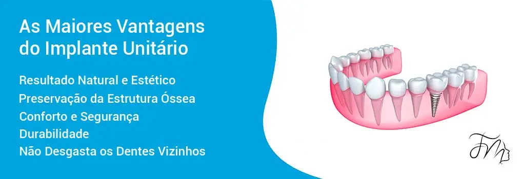 As Maiores Vantagens do Implante Unitário em Blumenau, Carlos Gomes Odontologia.