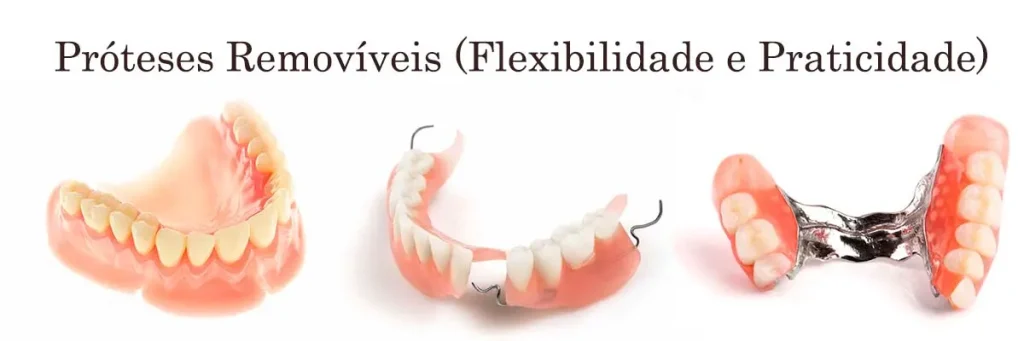 Próteses Removíveis - Carlos Gomes Odontologia