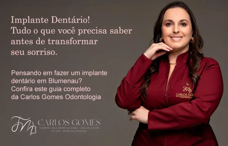 Tudo o que Você Precisa Saber Sobre Implante Dentário!