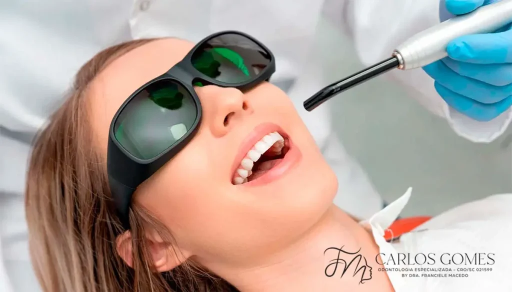 O que é, e Como Funciona o Tratamento com Laserterapia em Blumenau? - Carlos Gomes Odontologia. O que é, e Como Funciona o Tratamento com Laserterapia em Blumenau? - Carlos Gomes Odontologia.